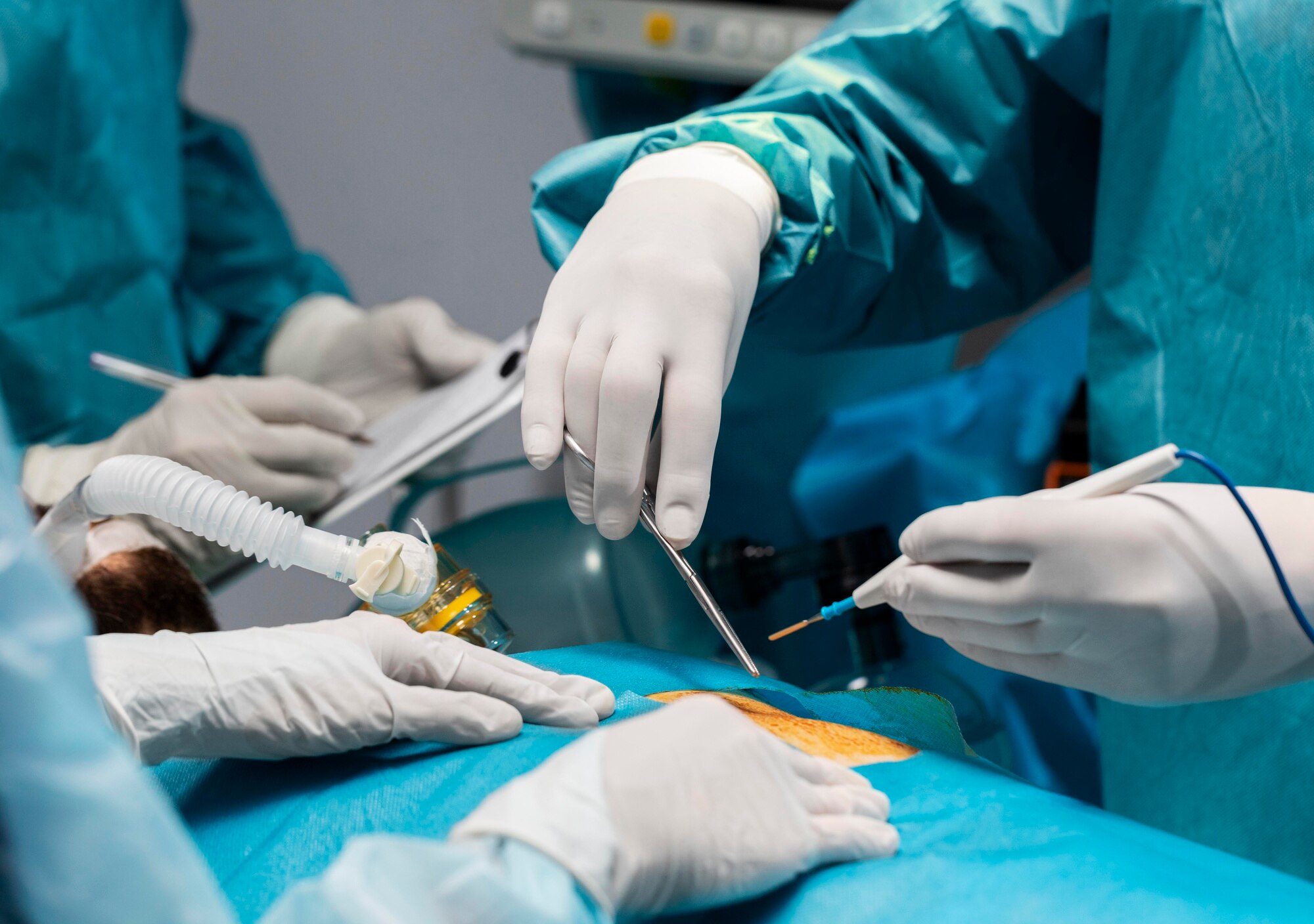 Surgery